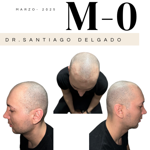 Caso M-0 — registro pre-procedimiento, Dr. Santiago Delgado
